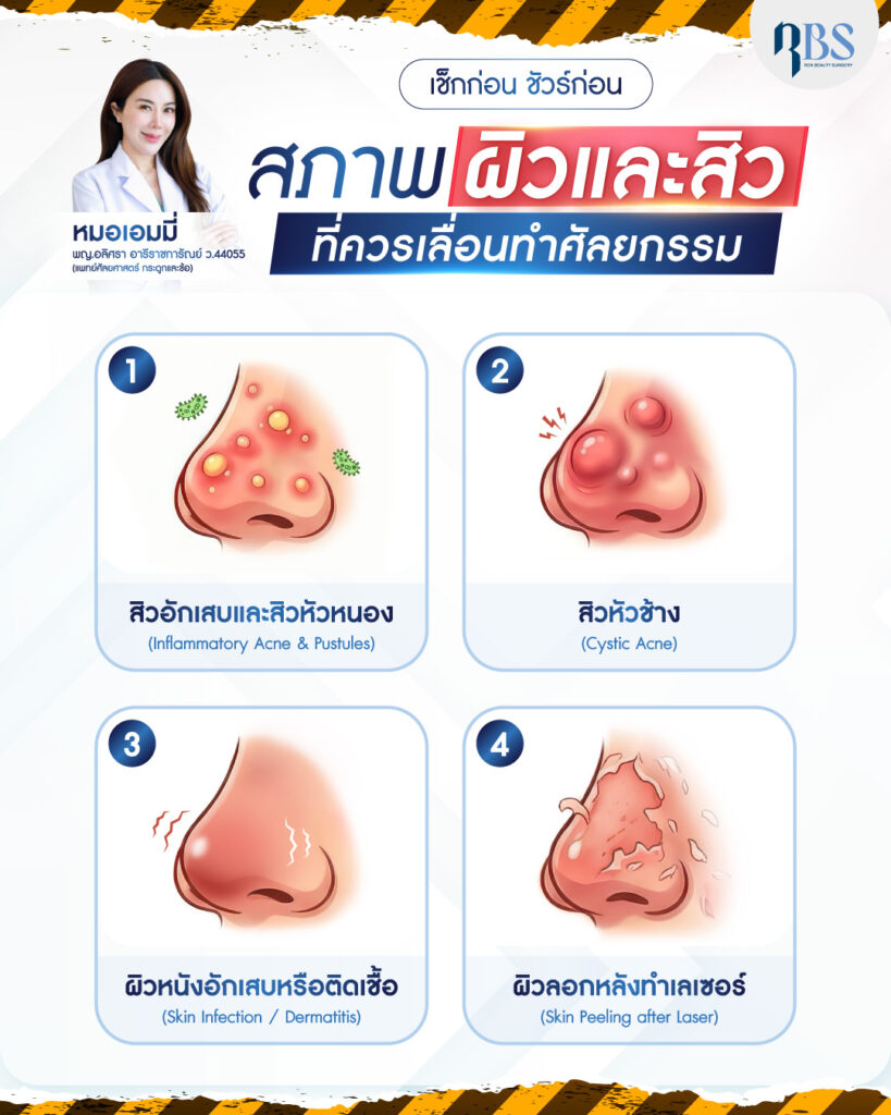 ข้อควรรู้ก่อนทำศัลยกรรม
