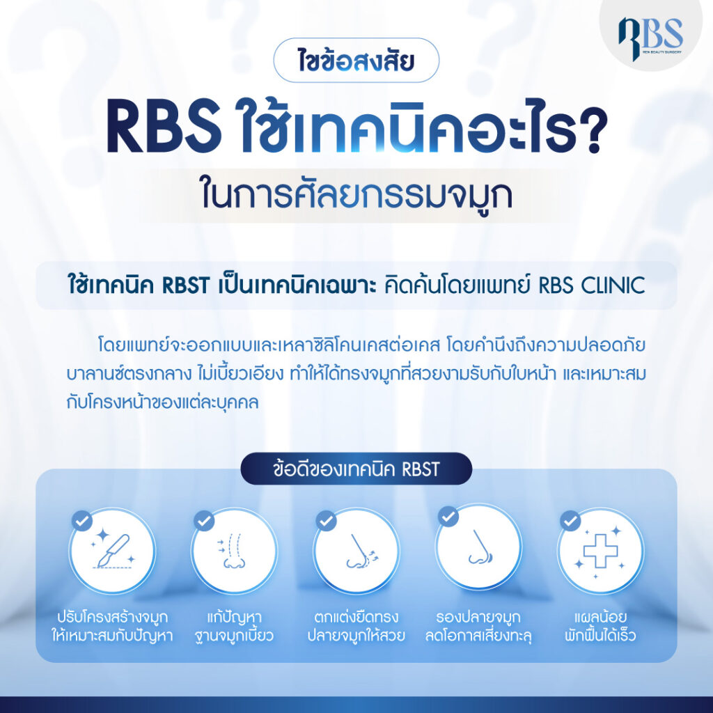 เทคนิค RBST