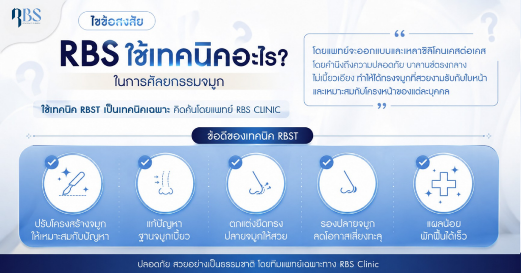 เทคนิค RBST